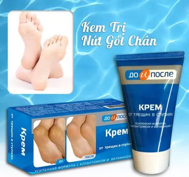 Trị nứt gót chân  KPEM (Apteka - Nga) hộp 1 tuýp 50ml