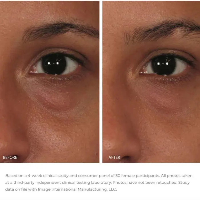 https://cdn.medigoapp.com/product/Gel_duong_am_giam_nhan_vung_mat_Image_Ormedic_Balancing_Eye_Lift_Gel_1_a62641a3cb.jpeg