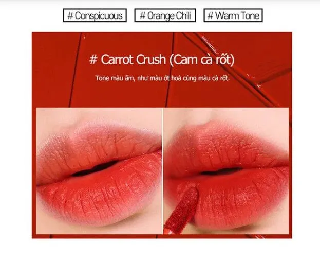 https://cdn.medigoapp.com/product/cam_ca_rot_d15aa5b0a7.jpg