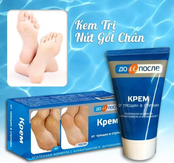 https://cdn.medigoapp.com/product/e137c20c0d96448eb49ca877722ce479.jpg