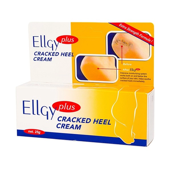 Kem làm ẩm da gót chân Ellgy Plus cream hộp 1 tuýp 25g
