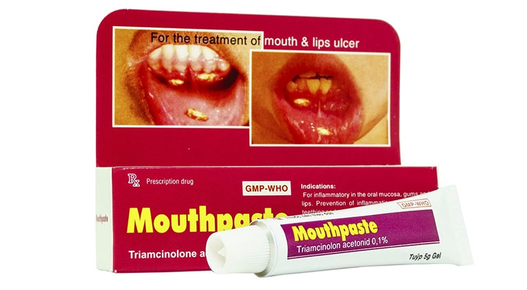 Thuốc điều trị viêm niêm mạc miệng và lợi Mouthpaste  hộp 1 tuýp 5g